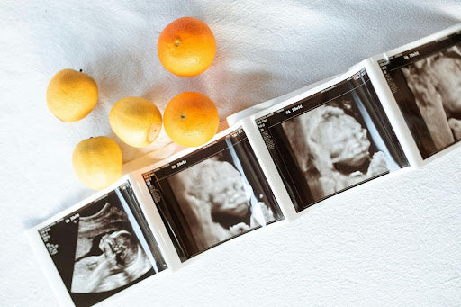 A Fruitful Journey: Your Month-by-Month Pregnancy Guide